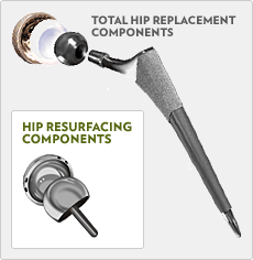 Hip Resurfacing Components